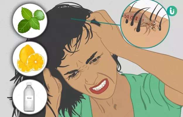 Get Rid of Lice: Effective Home Lice Treatment and Prevention Tips